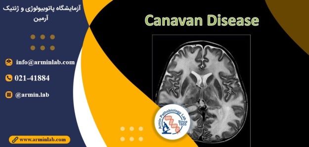 بیماری کاناوان