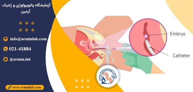 انتقال جنین در باروری آزمایشگاهی