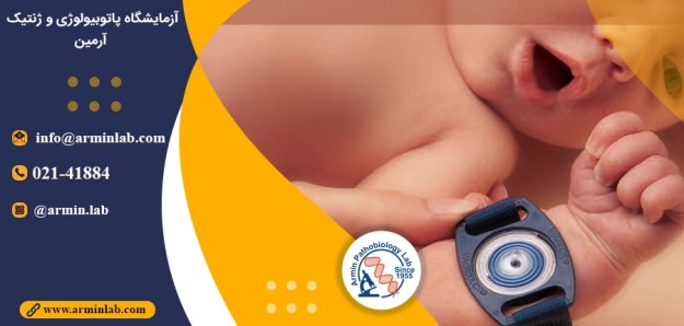 تست عرق برای فیبروز کیستیک