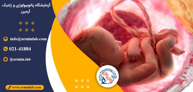 انواع مشکلات بند ناف