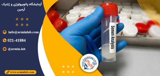 آنالیز مایع منی