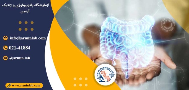 اثر آنتی بیوتیک بر IBD