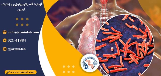 تشخیص بیماری سل با DNA