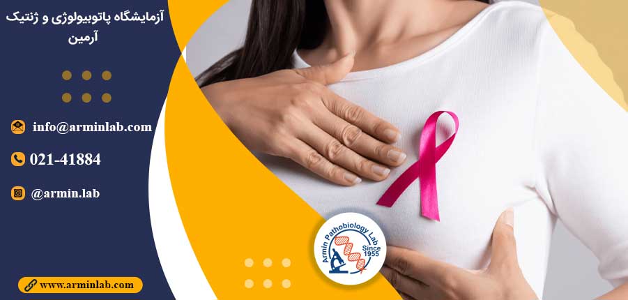 سرطان در سینه های متراکم