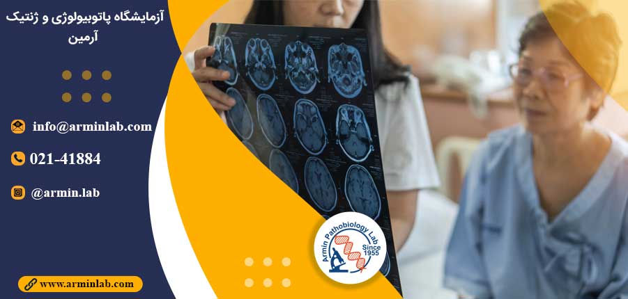 استروژن و کاهش سکته مغزی