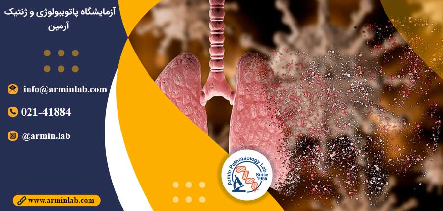 اومیکرون و آسیب به ریه