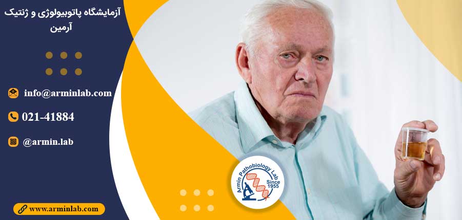 بیومارکر ادرار و بیماری آلزایمر