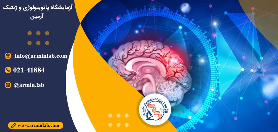 سرطان مغز و درمان آن