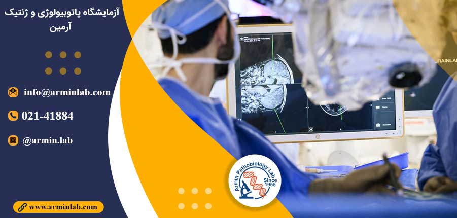 متاستازهای-مغزی-آزمایشگاه-آرمین متاستازهای مغزی ملانوما