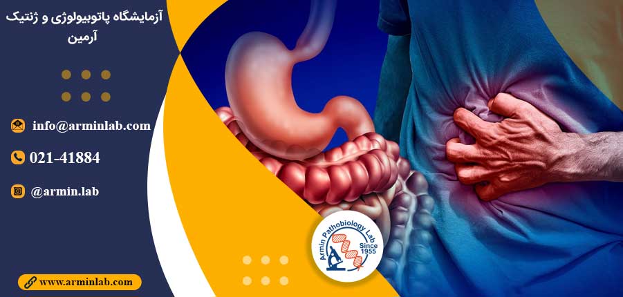 عفونت نوروویروس و بیماری کرون