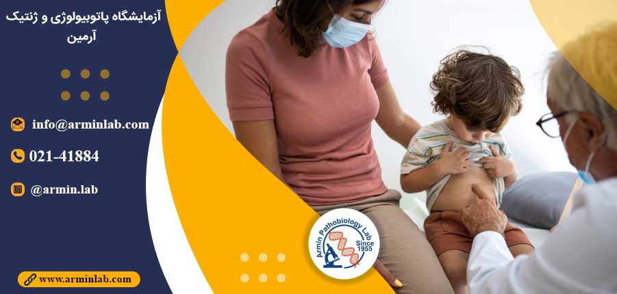 هپاتیت حاد در کودکان