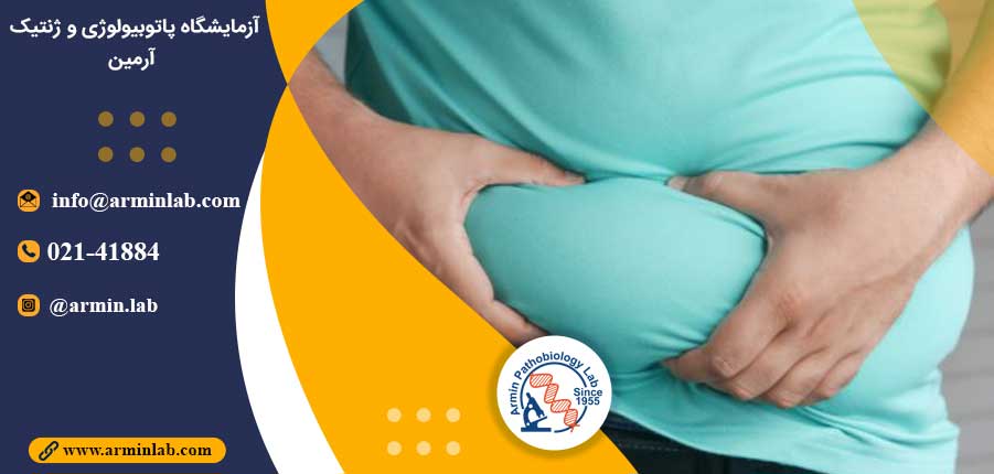 چاقی و سلول های ایمنی