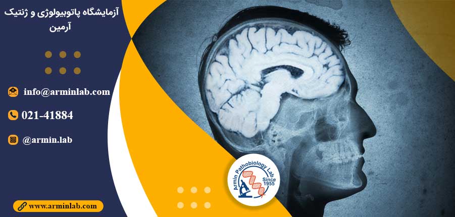 کنترل مغز در برابر بیماری ها