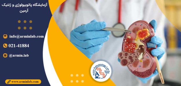 گلوکز در کلیه پلی کیستیک