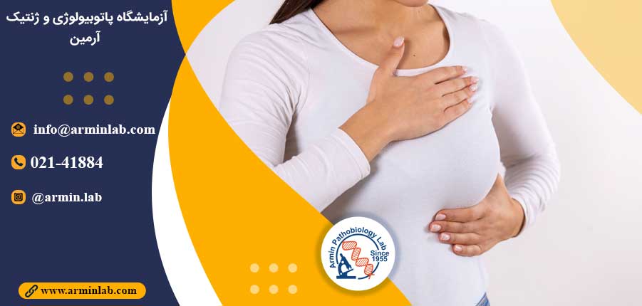 رشد تومور در سرطان سینه