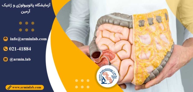 سرطان روده بزرگ و رژیم غذایی