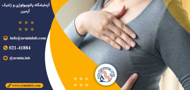 پیش بینی عود سرطان پستان