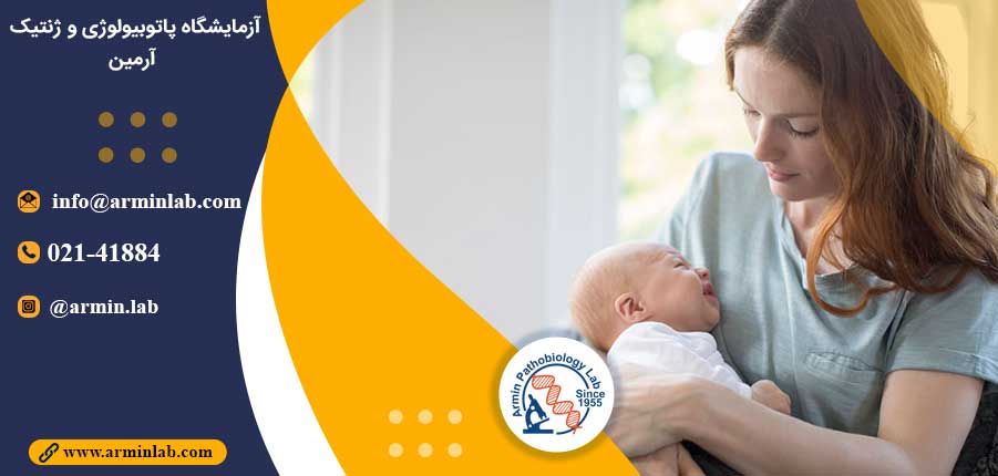 سندرم الکل جنینی