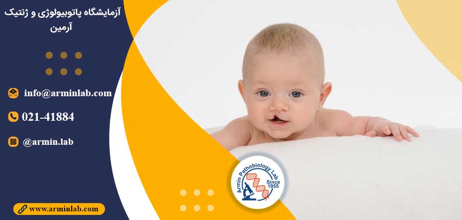 شکاف لب و کام