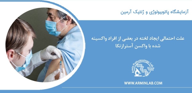 عوارض واکسن آسترازنکا