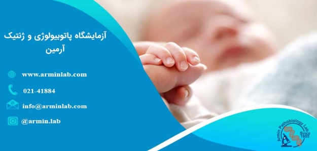 بیماری تای ساکس