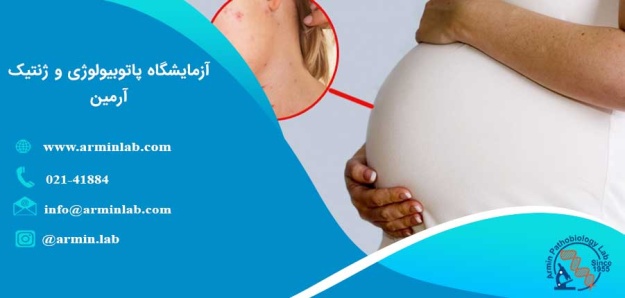 سرخجه در بارداری