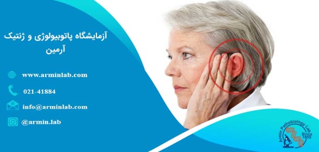 سکته گوش یا ناشنوایی ناگهانی