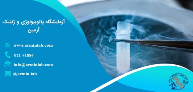 استخراج و فیریز اسپرم