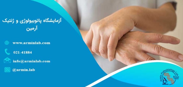 مواد شیمیایی و پارکینسون