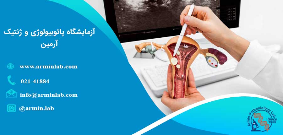 علائم پولیپ دهانه رحم