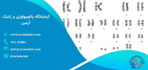 کاریوتایپ در دوران بارداری