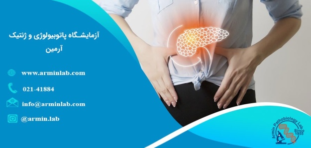 آزمایش لیپاز