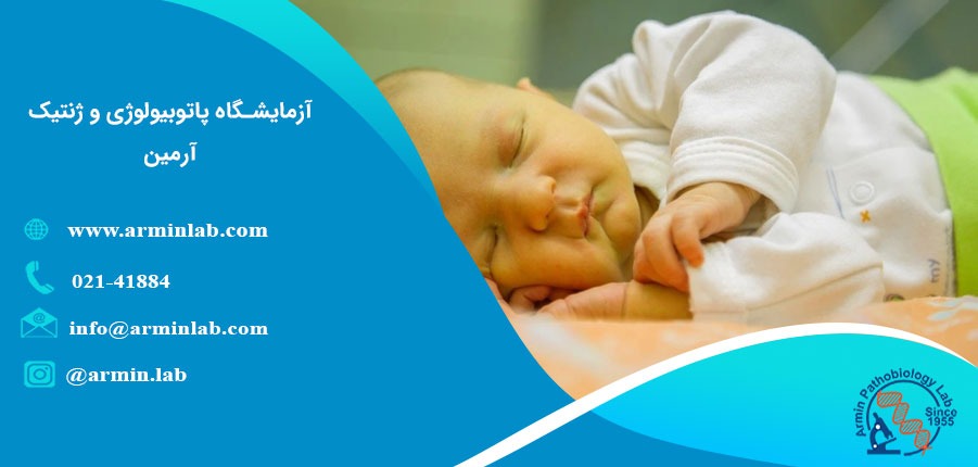 زردی در نوزادان