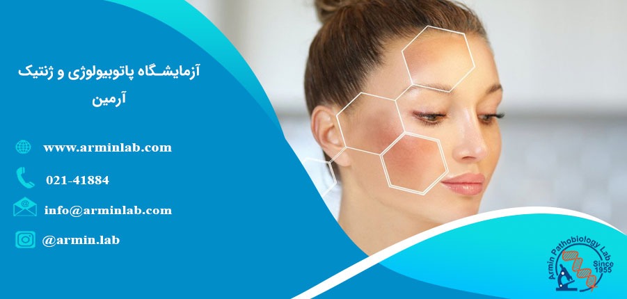 ملاسما چیست؟