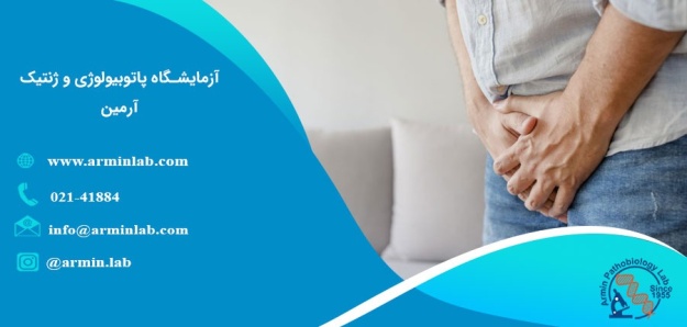 واریکوسل، علل و درمان