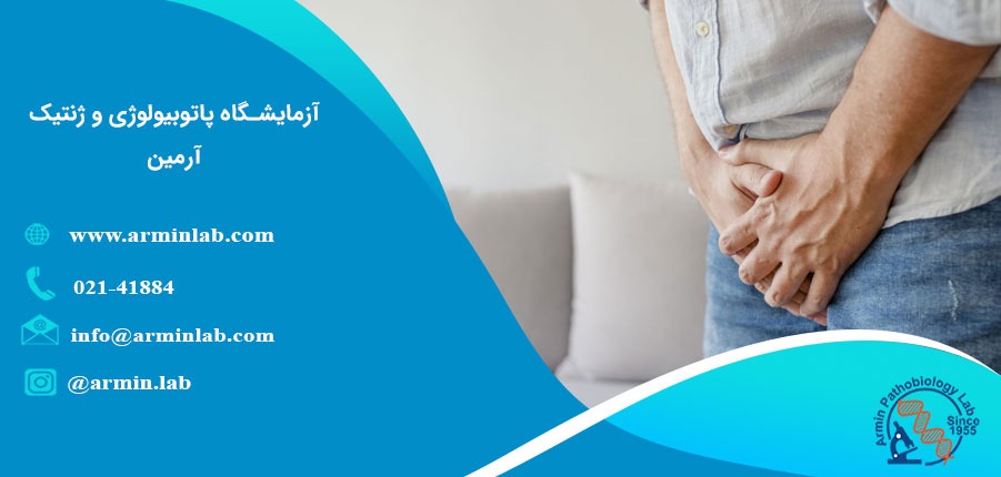 واریکوسل، علل و درمان