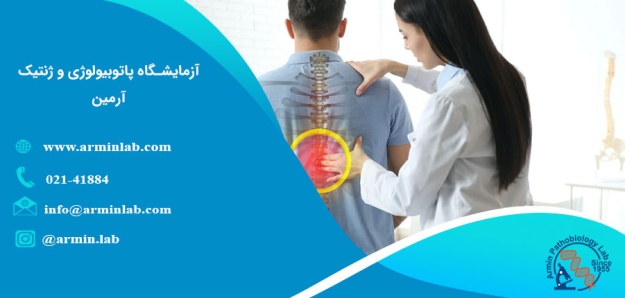 پوکی استخوان در مردان