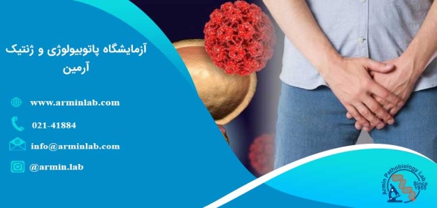 بزرگ شدن پروستات