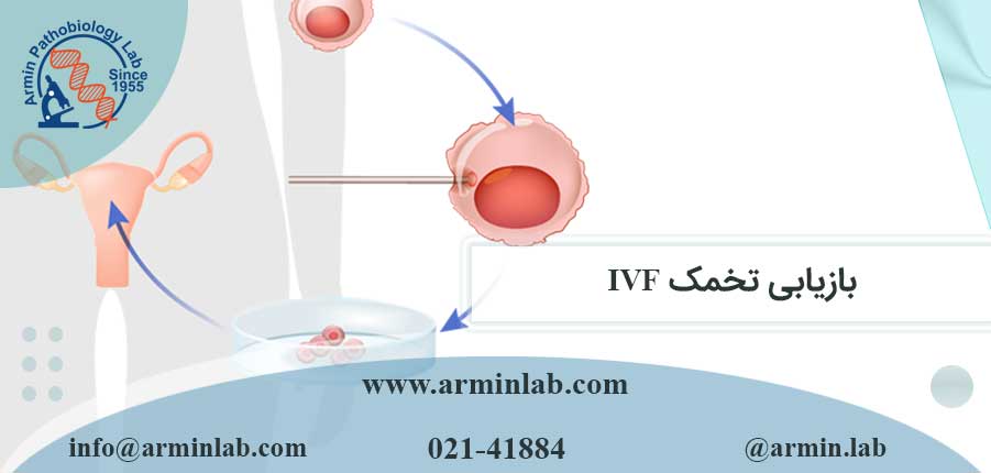 بازیابی تخمک IVF