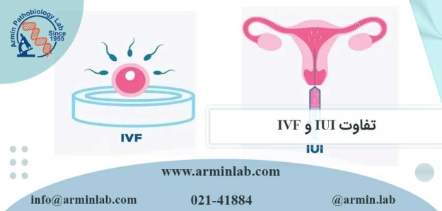 تفاوت IUI و IVF