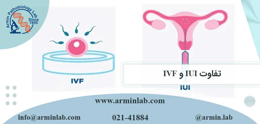 تفاوت IUI و IVF