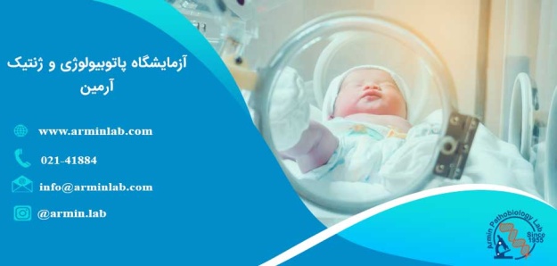 زایمان زودرس