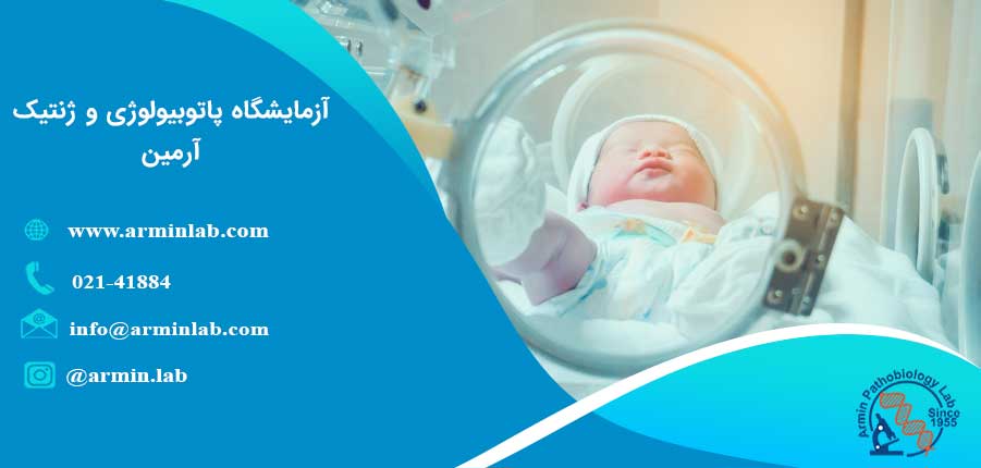 زایمان زودرس