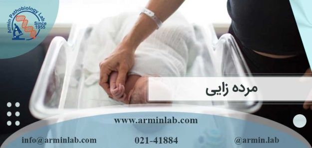 مرده زایی چیست؟