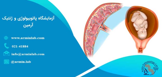 نارسایی جفت: علل و درمان