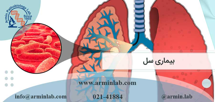 بیماری-سل-arminlab بیماری سل