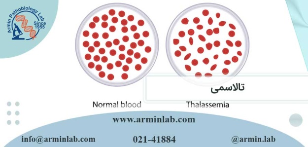 تالاسمی