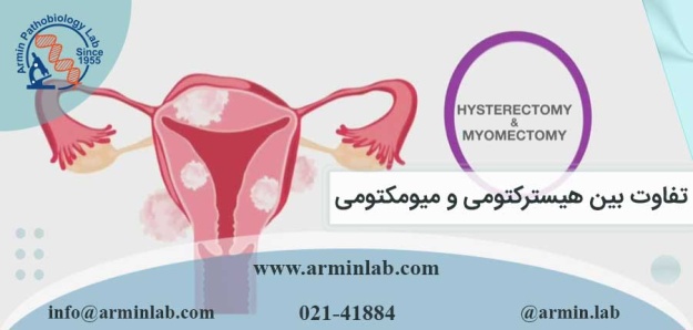 تفاوت بین هیسترکتومی و میومکتومی
