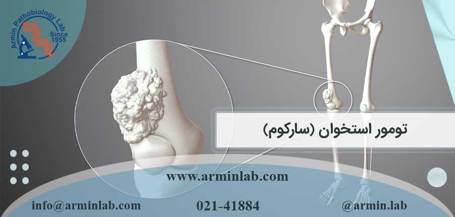 تومور-استخوان-(سارکوم)-arminlab تومور استخوان (سارکوم)