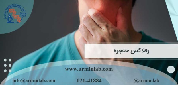 رفلاکس حنجره